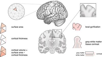 Structural neuroimaging phenotypes and associated molecular and genomic underpinnings in autism: a review